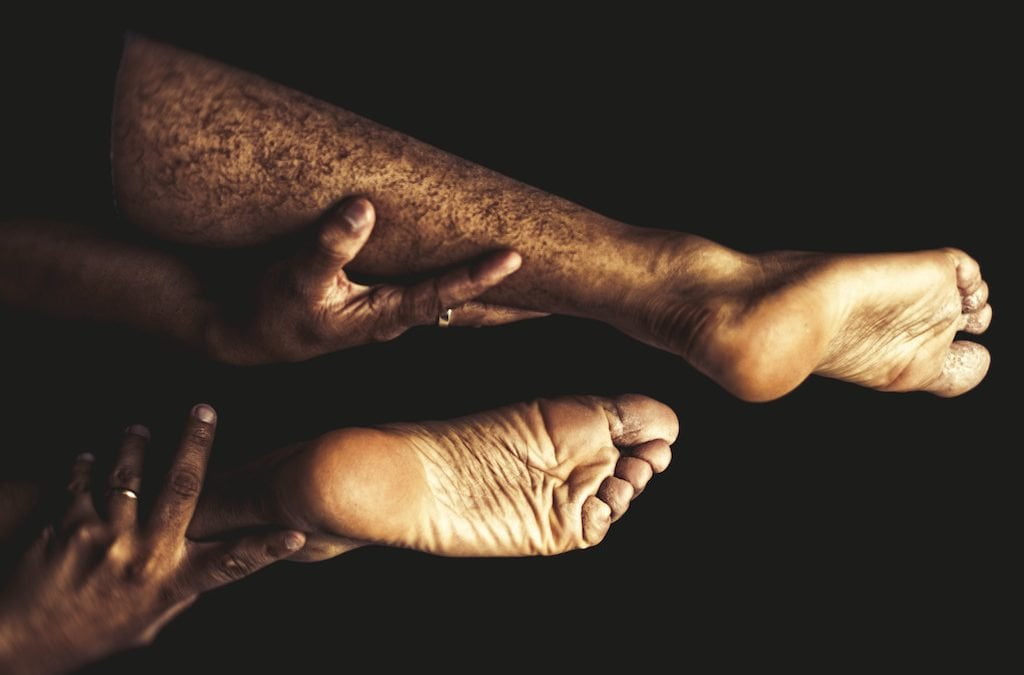 Common injuries in Car Accidents: Leg injuries